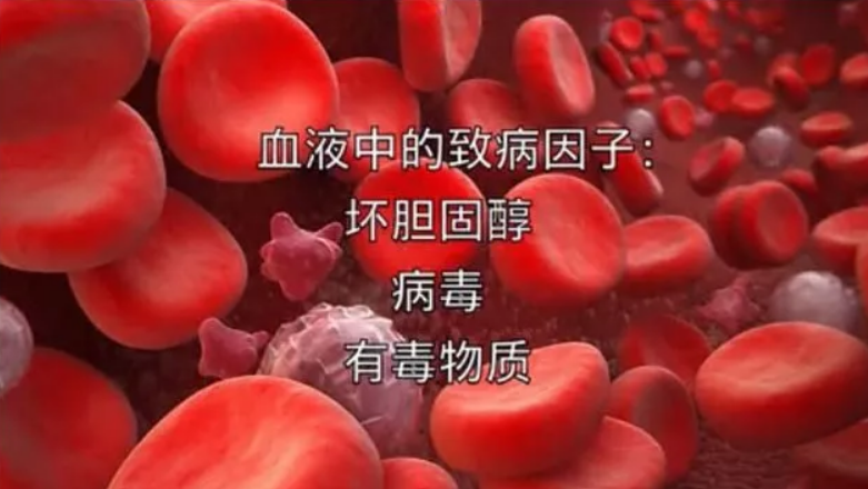 日本血液净化