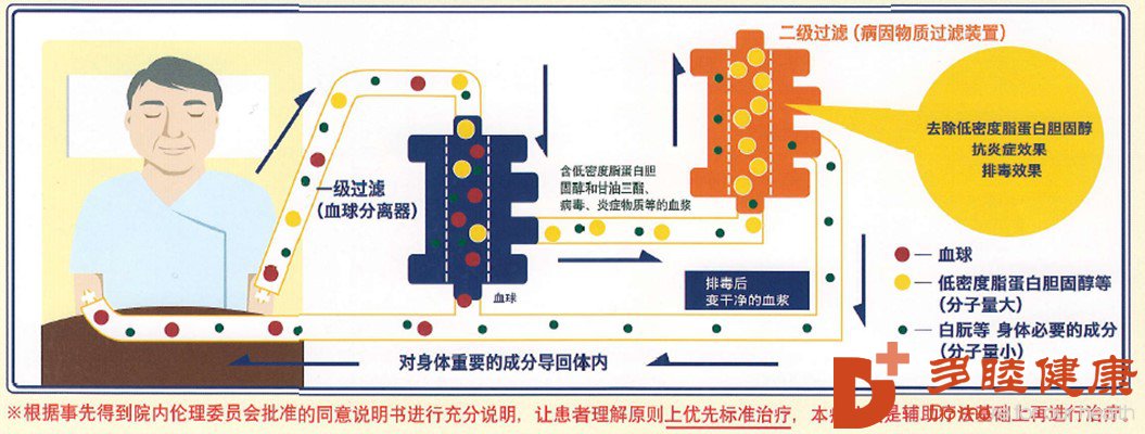 日本先端血液净化疗法：突破人类平均寿命的限制