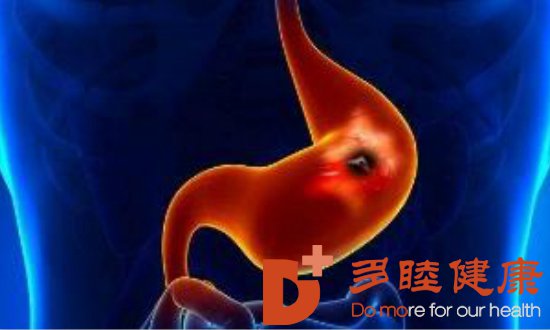 癌研有明|有这些习惯的人要警惕胃癌找上门