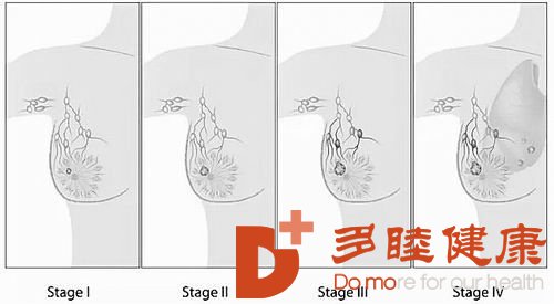 癌研有明|新标志物让乳腺癌“现形”