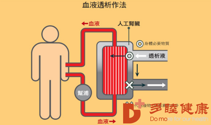 血液净化：尿毒症，末期肾脏病的针对性的治疗有哪些？