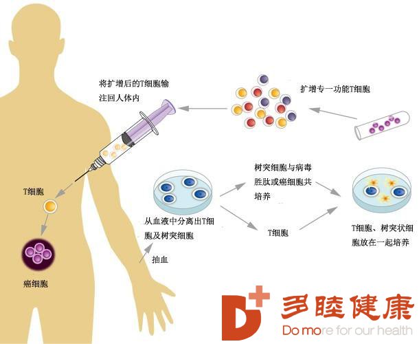 日本免疫细胞治疗的癌症
