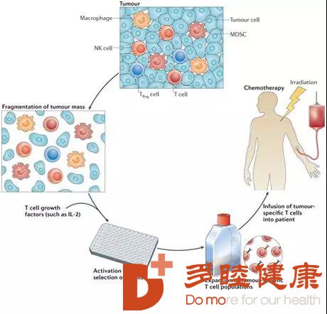 日本细胞疗法帮助癌患者攻克癌症的复发和转移