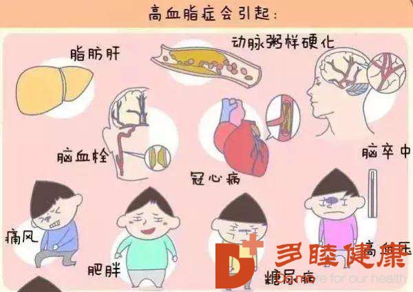 血液净化：长期高血脂会引发心血管疾病
