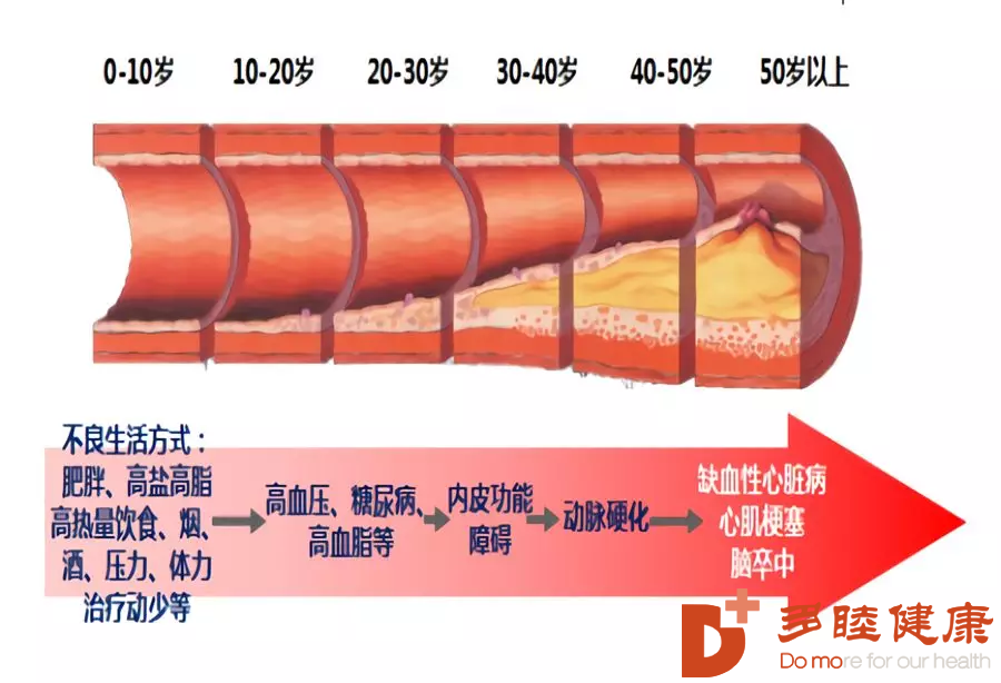 血液净化：防微杜渐保护心脏，这些事是患者得知道的