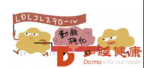 血液净化：动脉硬化斑块并非来自血液中的脂肪