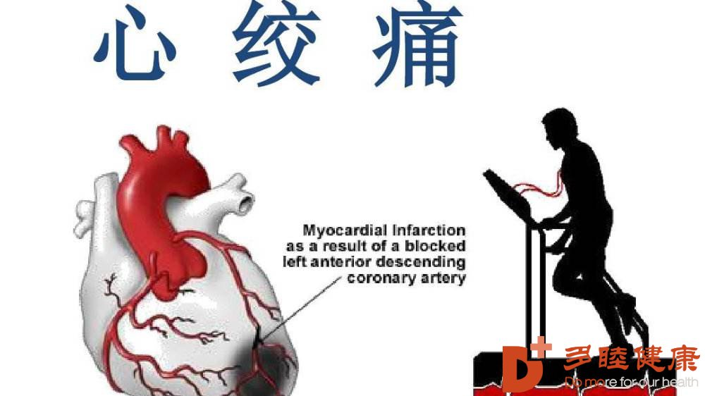 血液净化:如何区别心绞痛的三种类型,其中一种最为致命