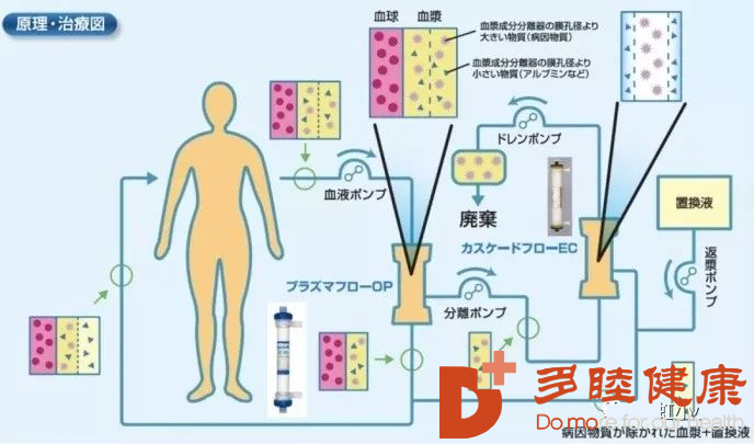 透析血管娄是什么原理_肝透析是什么情况(3)