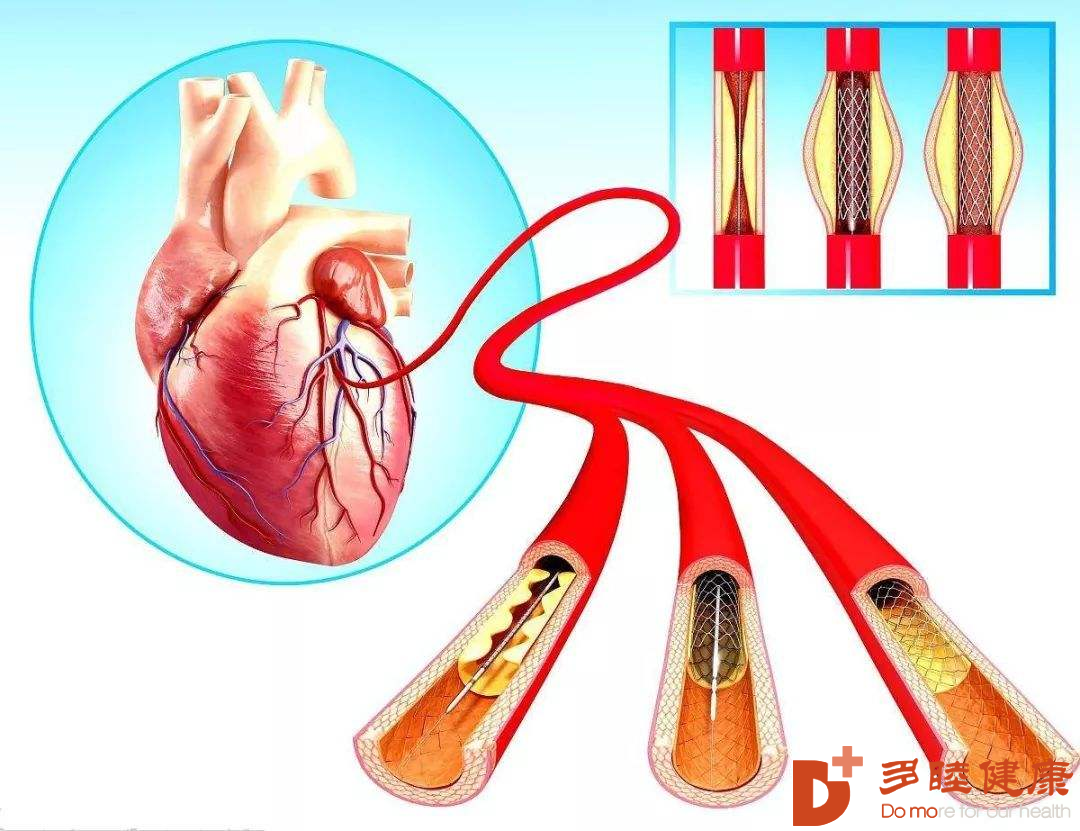 图32-8 Ⅱ型共同动脉干的手术矫正-心脏外科基础图解-医学