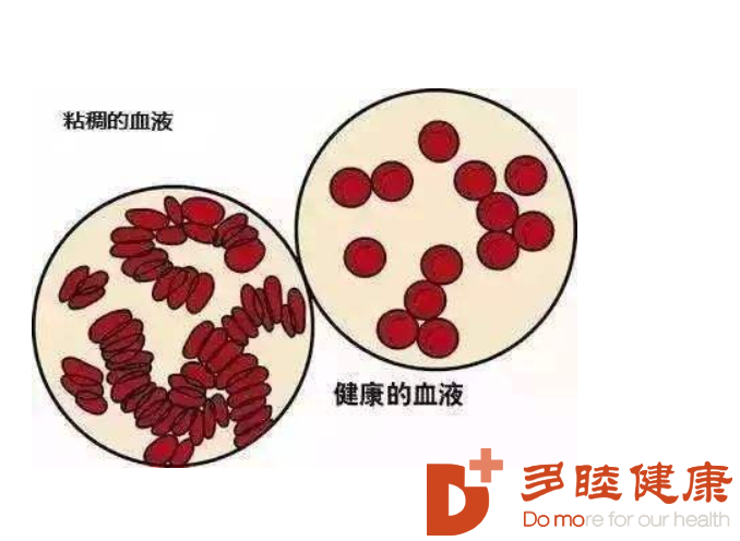多睦健康 血液净化小知识    血液是一种由蛋白质,脂肪,糖,水,无机