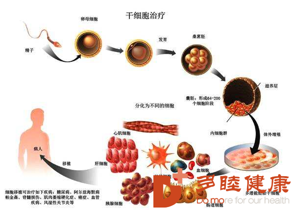 干细胞移植疗法