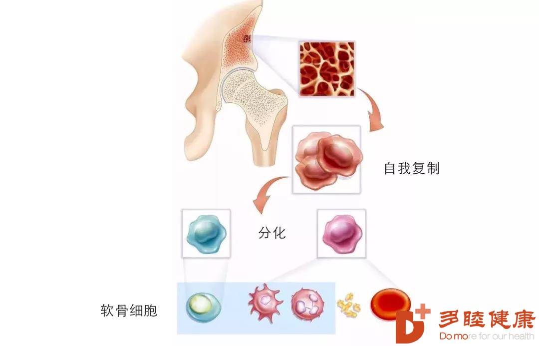 干细胞治疗：干细胞治疗慢性疼痛疾病的研究进展