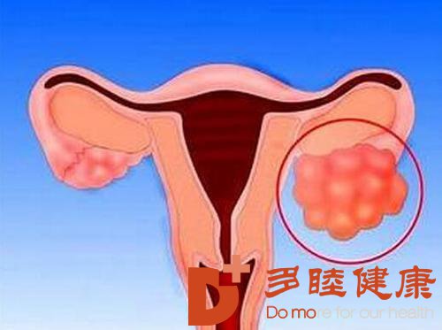 日本癌症治疗：卵巢癌如何应对放疗期间的食欲不佳
