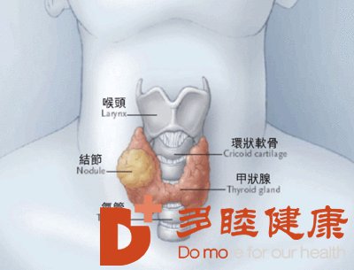 日本看病：甲状腺结节的增多与它们有什么关系？