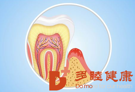 先端医疗|干细胞治疗牙龈萎缩