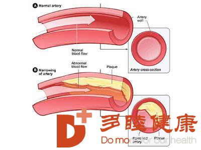 日本血液净化