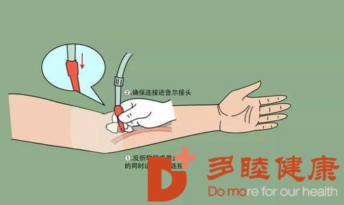 为什么日本血液净化如此受国人青睐呢