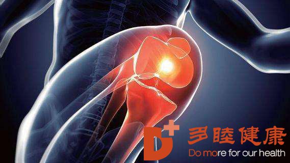 日本干细胞：骨关节炎的几大症状，一定要注意