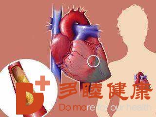 日本血液净化：动脉硬化有哪些表现 动脉硬化有哪些早期症状
