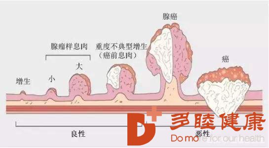 日本高端体检|日本体检查出身患大肠癌