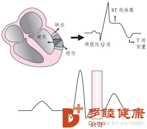 異常 stt