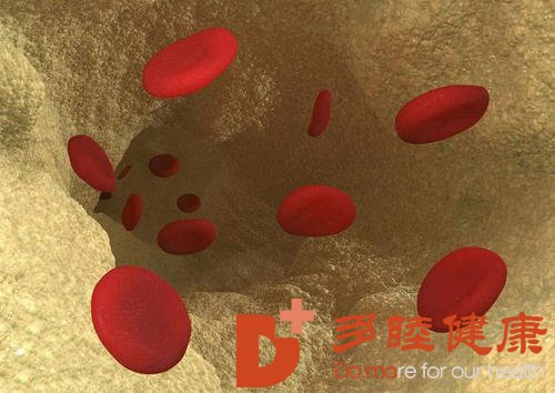 日本血液净化：预防心肌梗塞的发生 应该怎么做