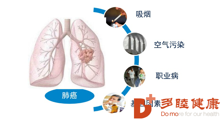 多睦健康详细讲解不同肺癌的区别