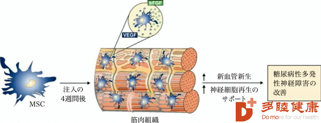 间充质干细胞对糖尿病性心肌病的效果