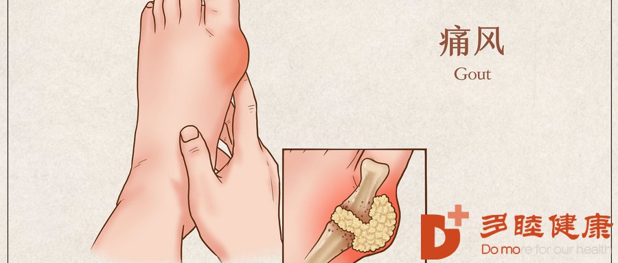 日本干细胞疗法是如何治疗痛风的？