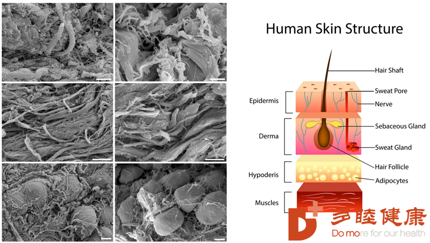 △ 间充质干细胞可以显著促进皮肤弹性纤维再生，获得皮肤年轻化的效果