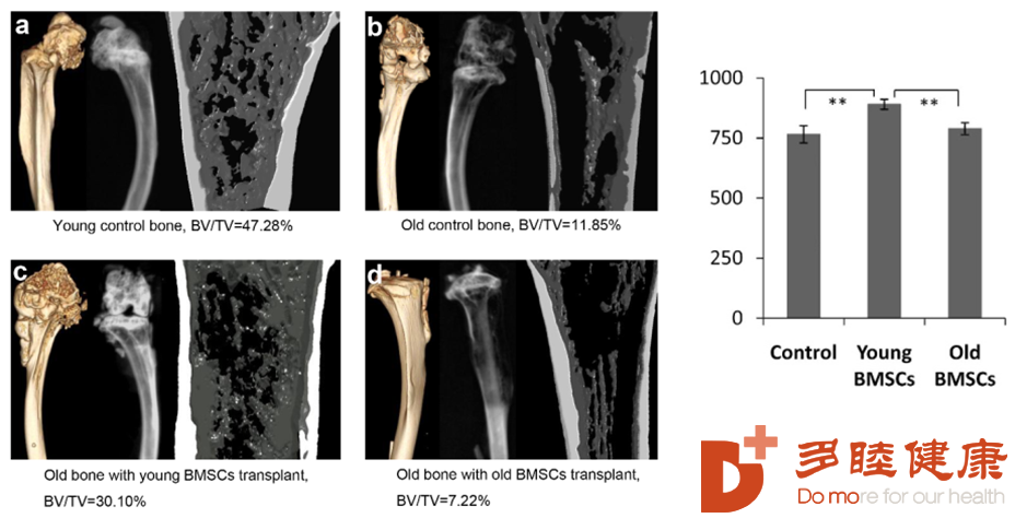 △ 年轻的间充质干细胞可以显著改善骨质疏松，同时可以显著提升寿命。