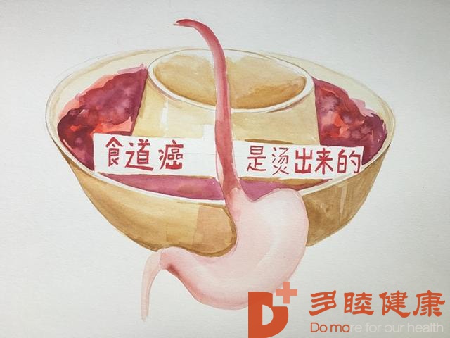 日本体检-天冷吃辣喝酒喝热汤「食道癌」风险飙升！