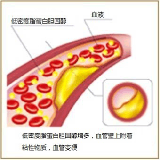 血液净化疗法图解-2